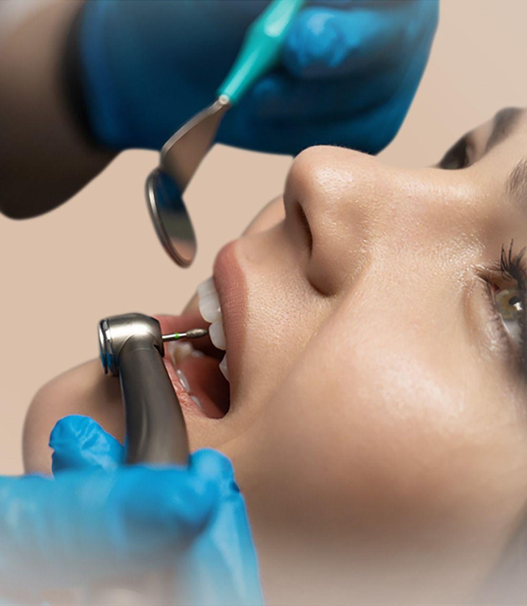 Root Canal Treatment