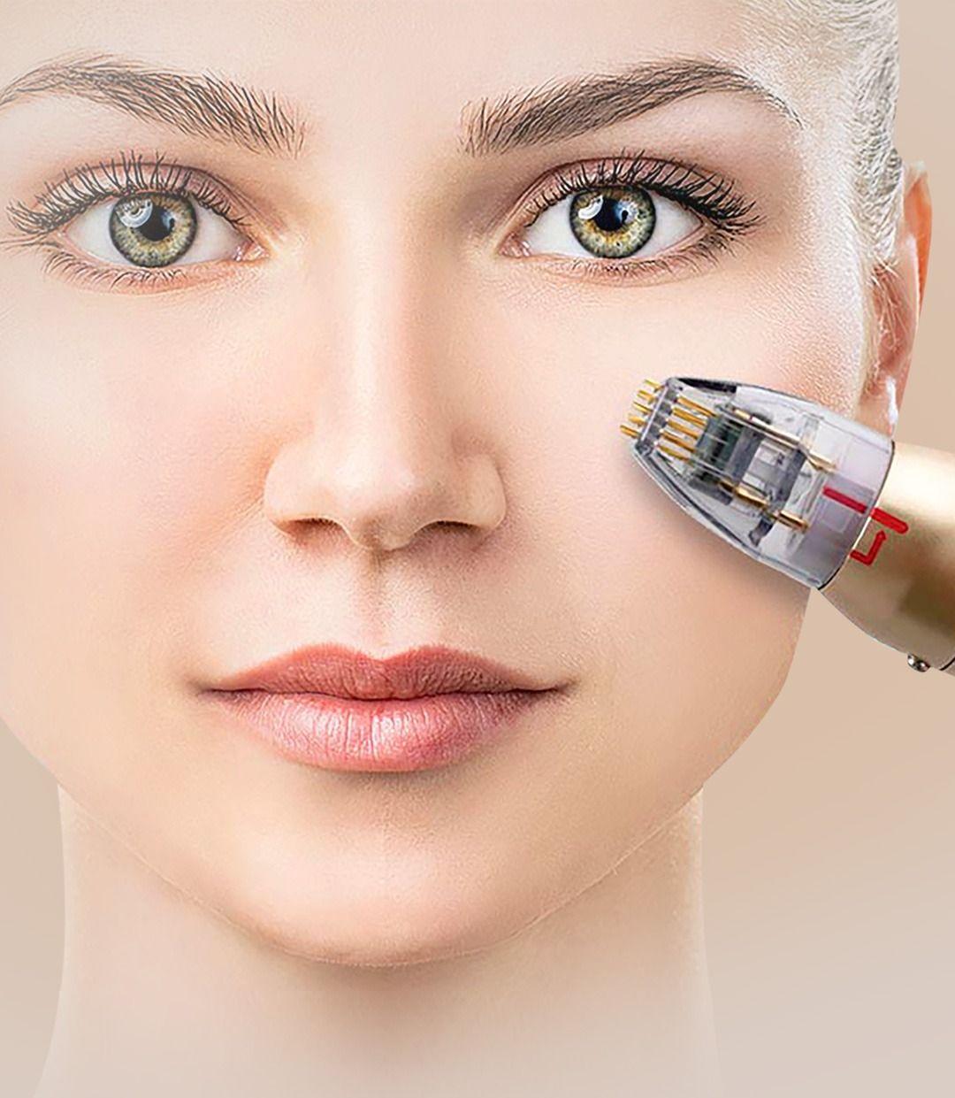 Microneedling